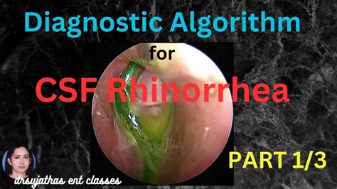 csf leak from nose test|CSF rhinorrhoea (TAU protein)